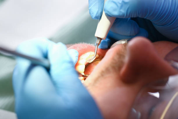 Best Emergency Dental Care for Abscessed Tooth in Paw Paw Lake, MI