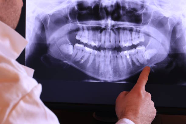Best Emergency Dental Care for Abscessed Tooth in Paw Paw Lake, MI