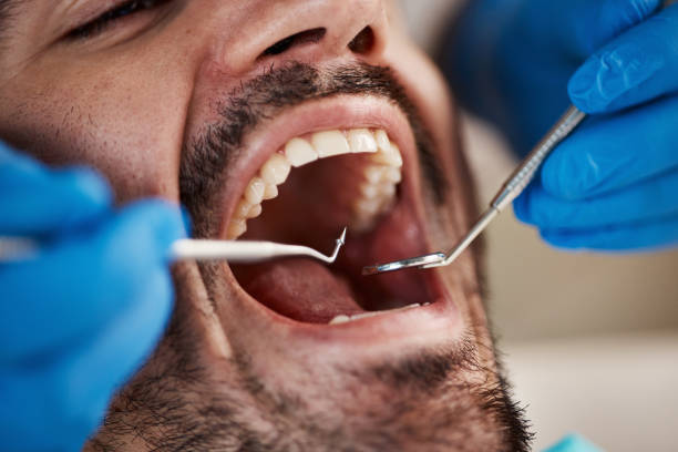 Best Emergency Dentist for Lost Fillings or Crowns in Paw Paw Lake, MI